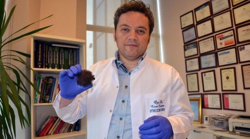 Zor İdrar Yapma Şikayeti İle Geldi, 220 Gram Ağırlığında Mesane Taşı &Ccedil;ıktı