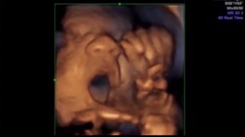 Anne karnında şarkıcılık denemesi: Doğuştan sanat&ccedil;ı dedikleri bu olsa gerek