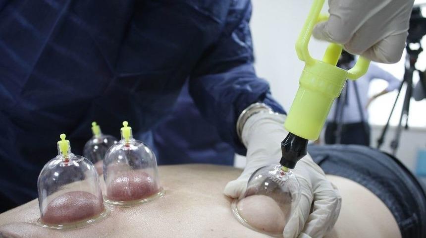 Antalya&rsquo;da Akapunktur Ve Hacamata Devlet G&uuml;vencesi