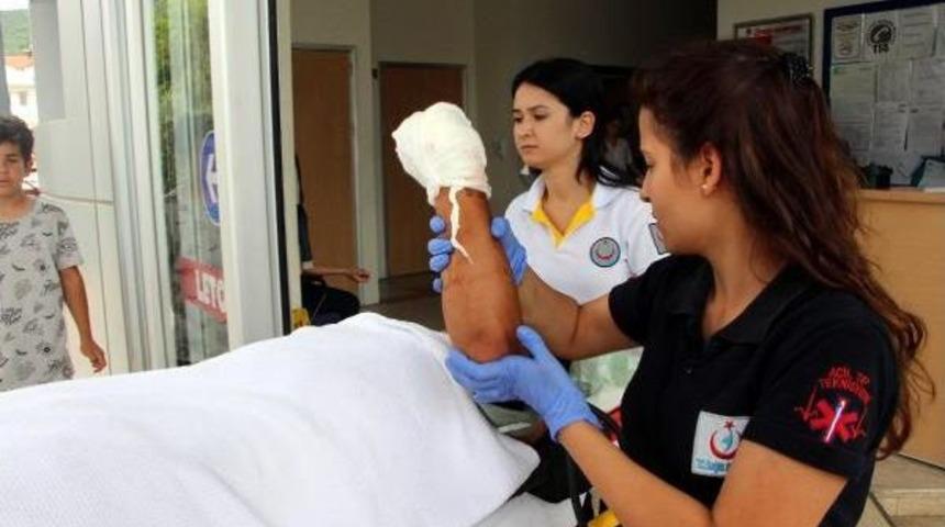 Otostopla Bindiği Otomobil Kaza Yaptı, Sol Eli Koptu