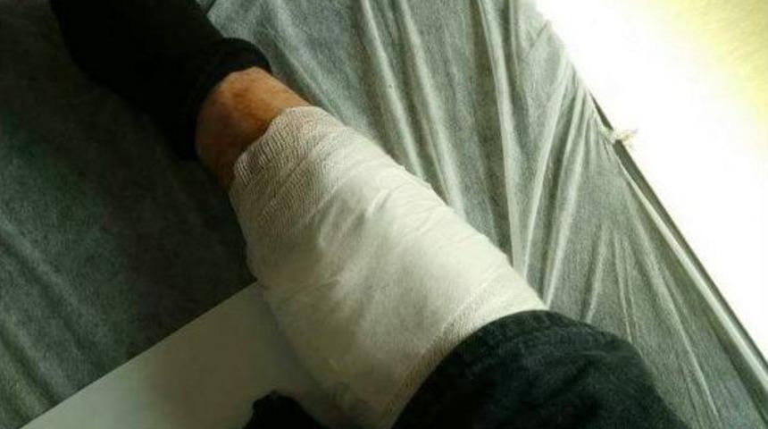 Tırpan Motorunun Fırlattığı Tel Par&ccedil;ası Hastanelik Etti