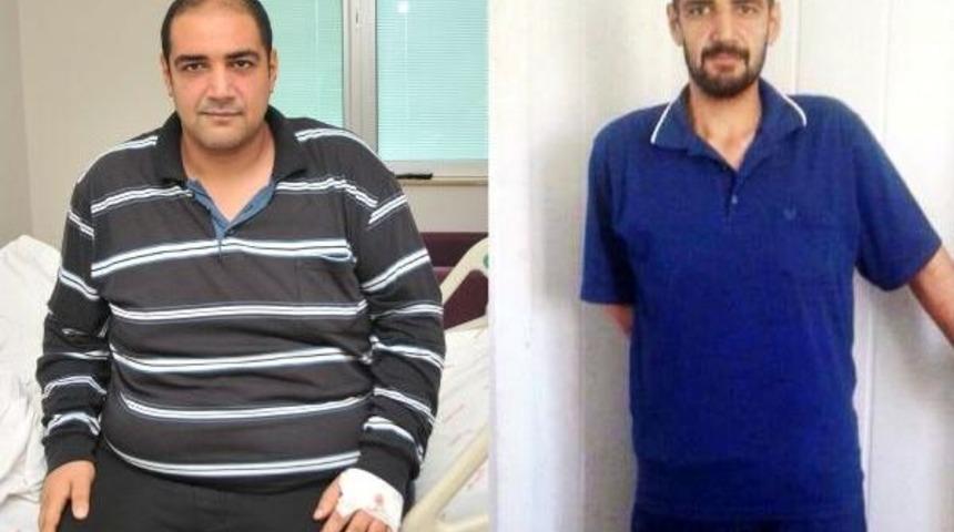 Mide Ameliyatıyla 5 Ayda 55 Kilo Zayıfladı