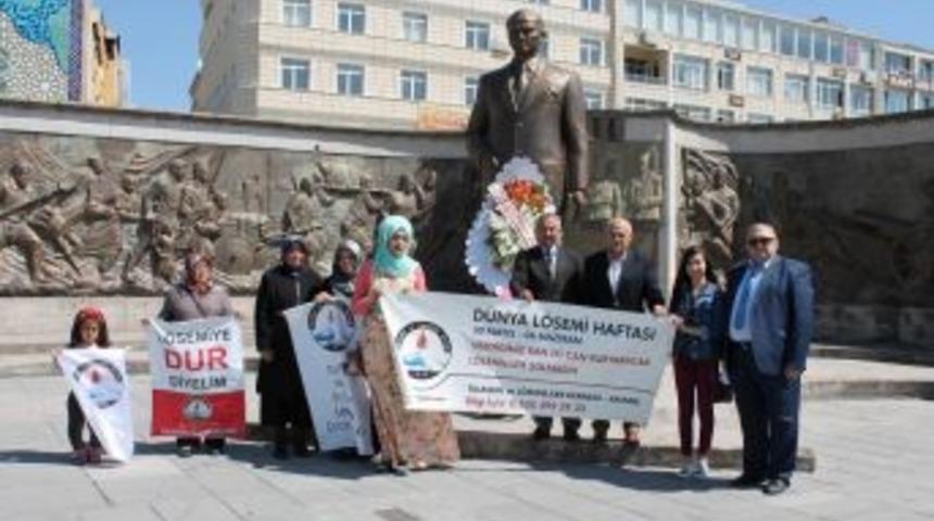 Kayseri&rsquo;de 284 L&ouml;semi Hastası Bulunuyor