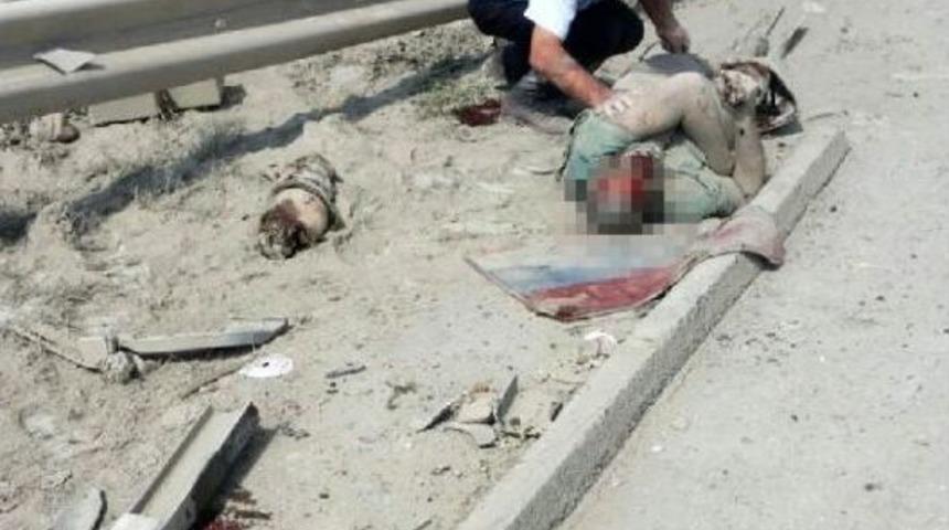 Kopan Bacağının Yanında Yardım Bekledi