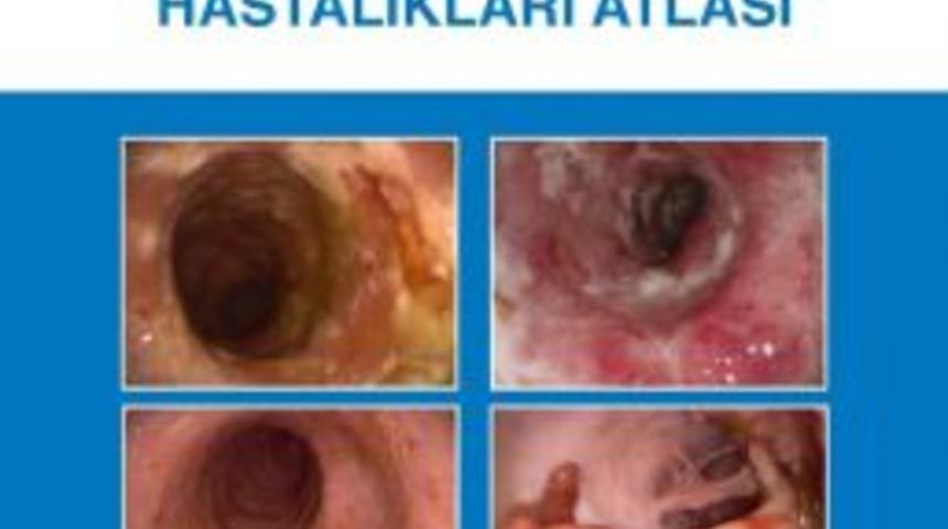 &lsquo;inflamatuar Bağırsak Hastalıkları Atlası&rsquo; Kitabı Yayımlandı