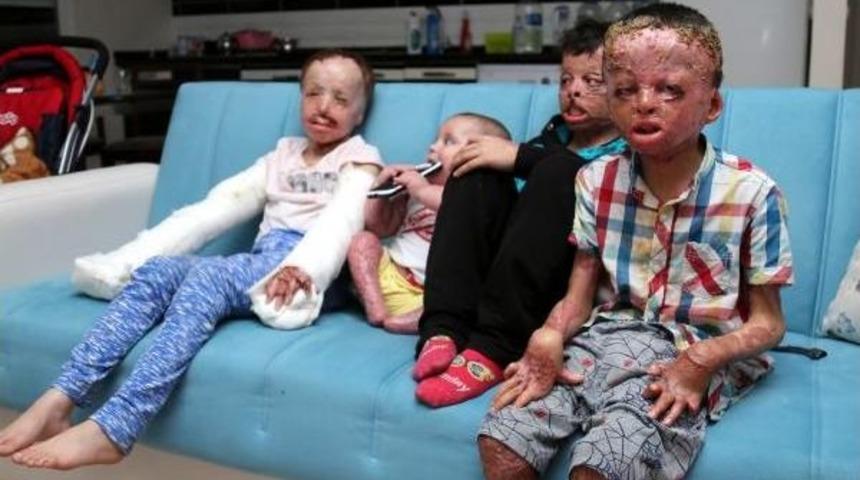 Suriye'deki Savaş Minik Bedenlerini Yaktı