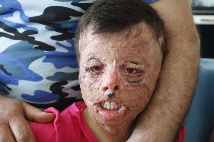 Suriye’nin Yaktığı Yüzler Antalya’da Gülüyor G3