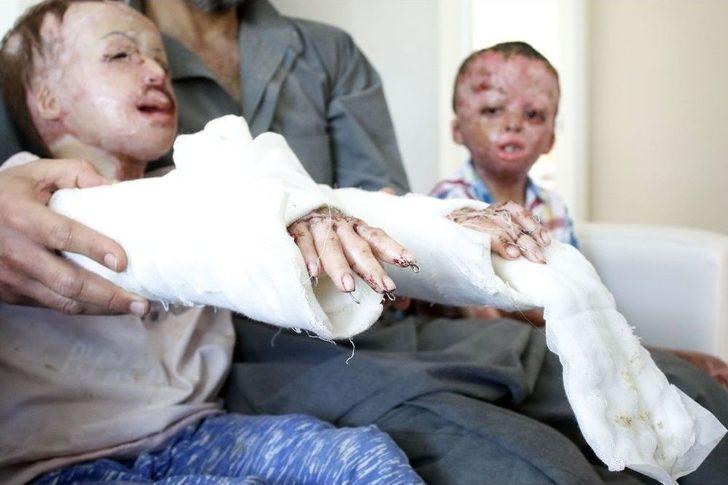 Suriye’nin Yaktığı Yüzler Antalya’da Gülüyor G4