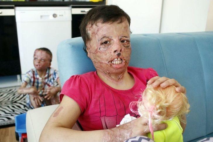 Suriye’nin Yaktığı Yüzler Antalya’da Gülüyor G5