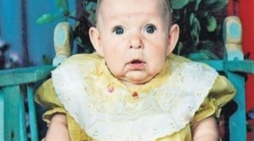 Babası suratını g&ouml;r&uuml;nce onu terk etti! 21 yıl sonra tokat gibi cevap verdi