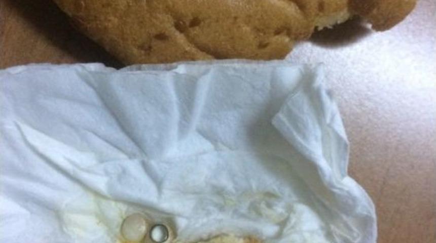 Pideden &Ccedil;ıkan &Ccedil;ivi 4 Dişini Kırdı