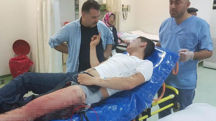 Bakışma Y&uuml;z&uuml;nden Bacağına Saplanan Bı&ccedil;akla Hastaneye Kaldırıldı