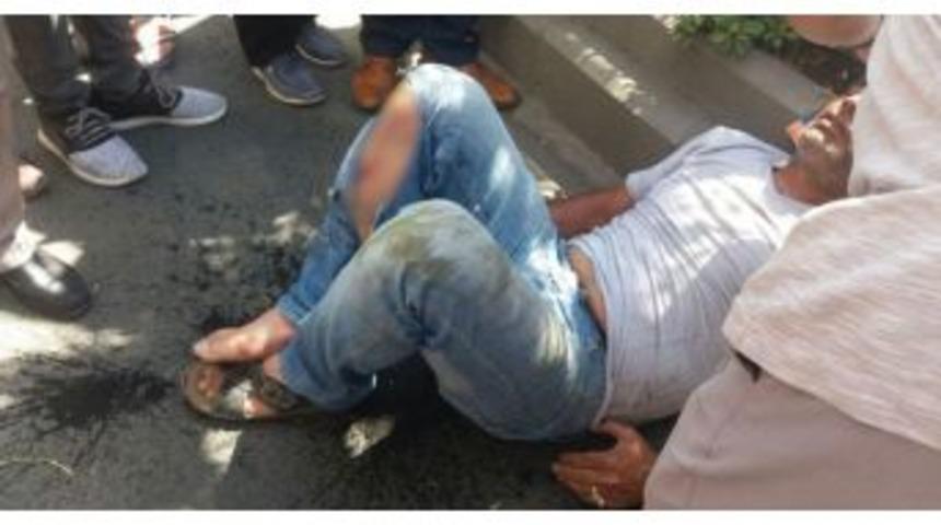 Otomobilin &Ccedil;arptığı Motosikletli Yaralandı