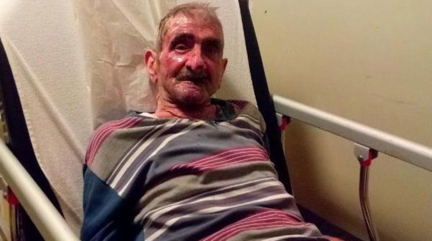 Oksijen Maskesi Ile Sigara I&ccedil;ti Bu Hale Geldi