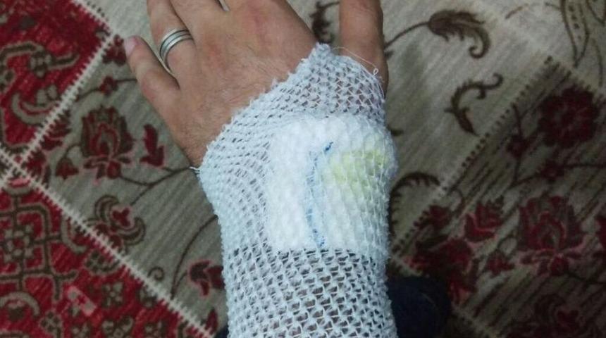 Yakalanan Sahte Polis, Gerçek Polisi Isırıp Kaçmaya Çalıştı