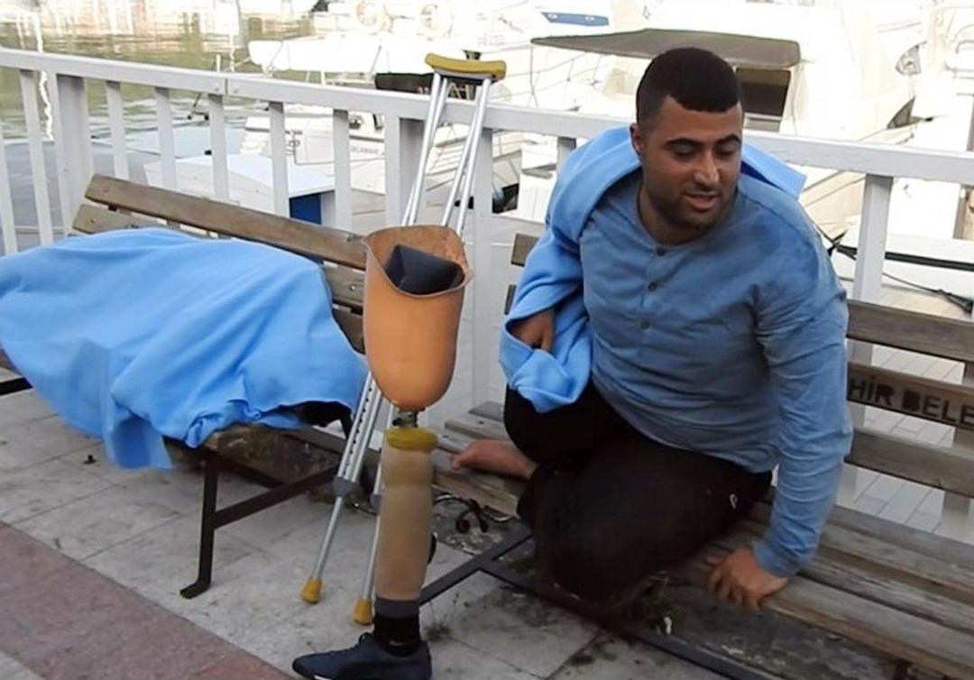 Savaşta Bacağını, Ka&ccedil;arken Umudunu Kaybetti