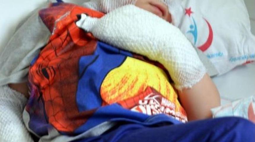 Yaktığı Ateşin Içine Düştü