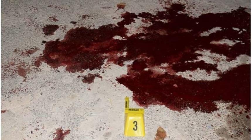 Av T&uuml;feği İle Yaralama Olayının Zanlısı Tutuklandı