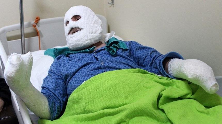 Biriken Gaz Bomba Gibi Patladı