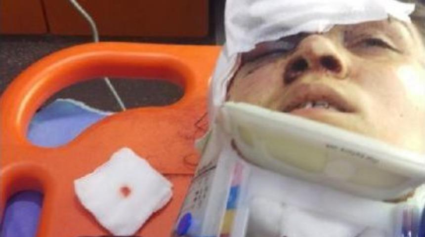 Eski Eşinin Boğazını Kesip Yaraladı, Yakalanınca Da 'yanımda Yoktu' Dedi