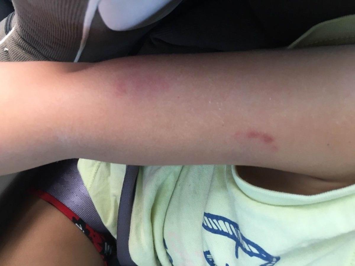 2 Yaşındaki &Ccedil;ocuğa Kreşte Darp