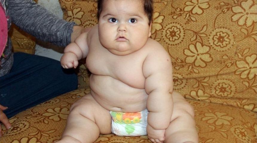 3,5 Kilo Doğdu 8 Ayda 20 Kiloya Ulaştı