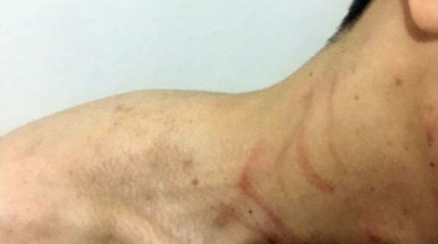 Hırsızlıkla Su&ccedil;ladıkları Genci &Ouml;nce Darp Ettiler, Sonra Tokalaşmak İstediler