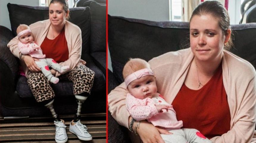 Sezaryenden uyanınca iki bacağının da kesildiğini görüp kabusu yaşadı