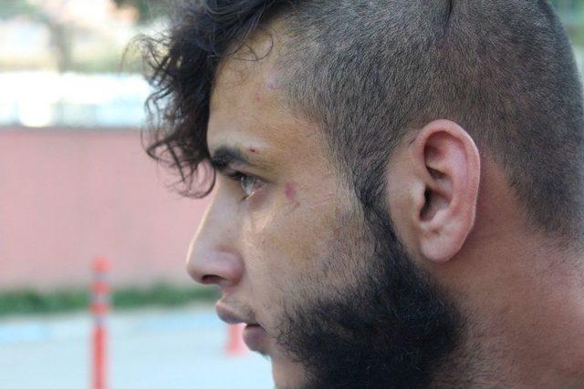 Suriyeli Gen&ccedil;, Beraber Ka&ccedil;tığı Kızın Ailesi Tarafından Darp Edildi 2