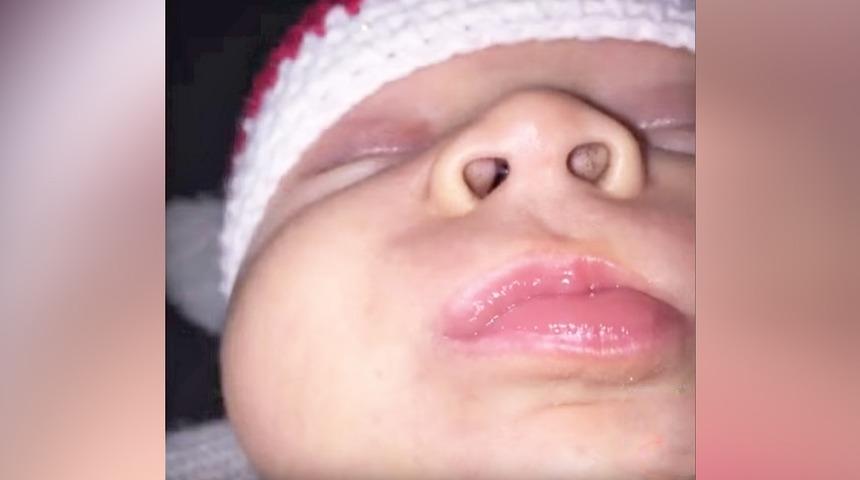 Anne bebeğinin burnunun i&ccedil;inde siyah lekeler g&ouml;rd&uuml;! Şimdi herkesi uyarıyor