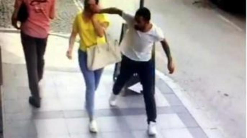 Y&uuml;z&uuml;ndeki G&ouml;zl&uuml;ğ&uuml; &Ccedil;alındı