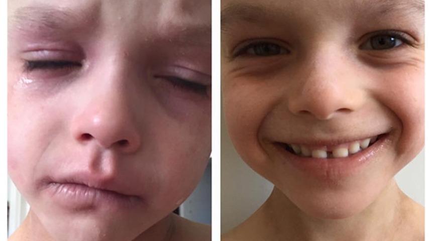 Doktorlar ağrılarını &ouml;nemsemedi! Hastalığın &ccedil;&ouml;z&uuml;m&uuml;n&uuml; annesi buldu 