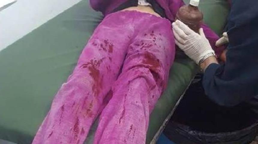 Pkk/pyd, Sivillere Top&ccedil;u Atışıyla Saldırdı: 4 &Ouml;l&uuml;, 20 Yaralı