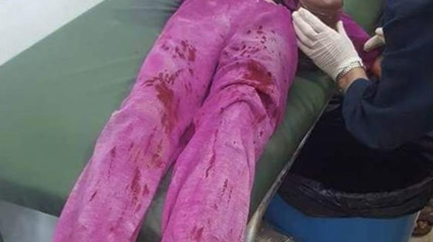 Pkk/pyd Suriye&rsquo;de Sivilleri Hedef Aldı: 4 &Ouml;l&uuml;, 20 Yaralı