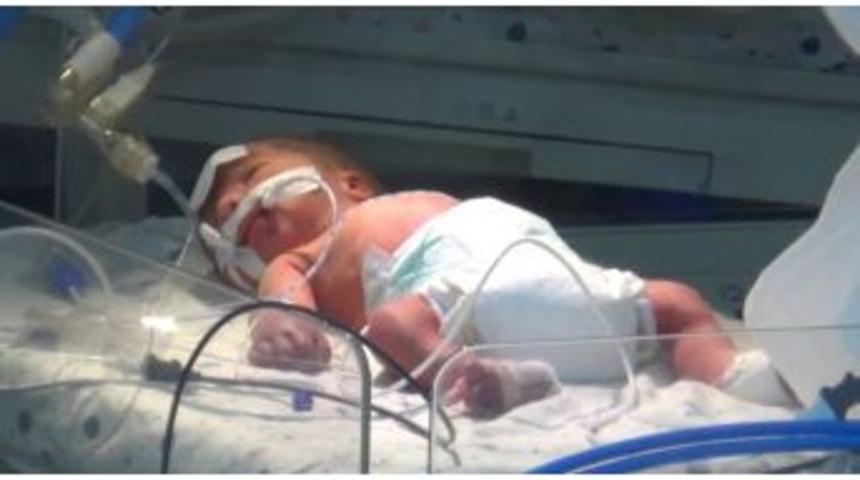 Annesi &Ouml;ld&uuml;r&uuml;len Bebeğin Hayati Tehlikesi S&uuml;r&uuml;yor