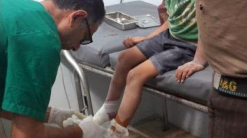 Pkk/pyd Tarafından, Azez Ve Mare&rsquo;ye Saldırı