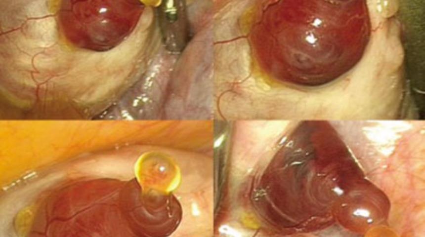 Kadınların Yumurtlama Anı Fotoğraflandı!