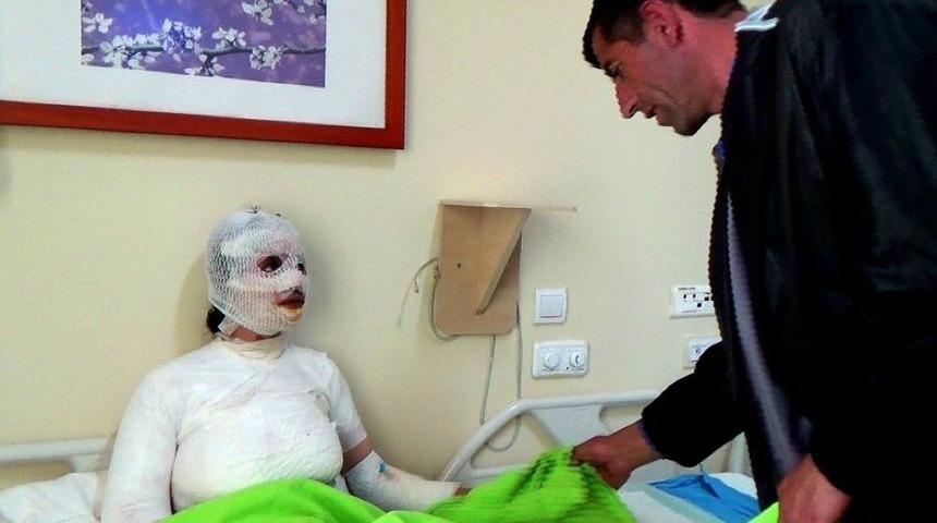 &Uuml;zerine Kaynar Su D&ouml;k&uuml;len 8 &Ccedil;ocuk Annesi Kadın Yandı