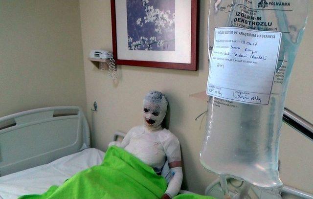 &Uuml;zerine Kaynar Su D&ouml;k&uuml;len 8 &Ccedil;ocuk Annesi Kadın Yandı 3