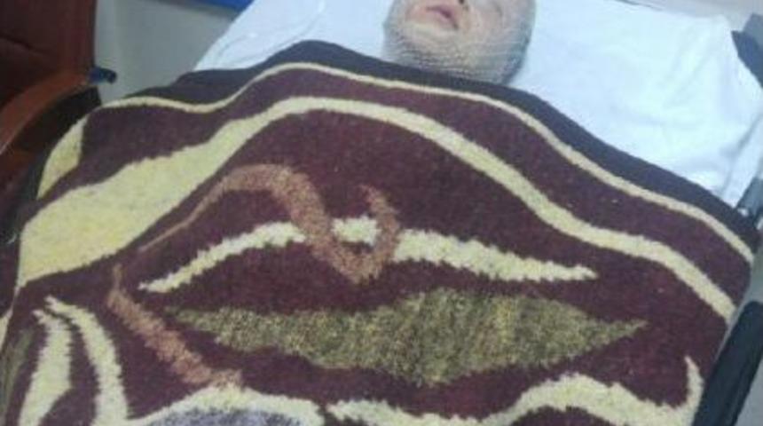 İnternetten Izledikleri Video Ile Yaptıkları Patlayıcı Parladı: 1 &Ccedil;ocuk Yaralı