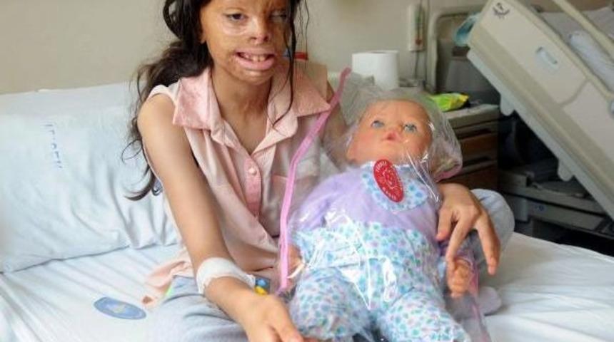 Yanık Tedavisi G&ouml;ren Serkan Ve Firdevs'e Yardım Yağıyor