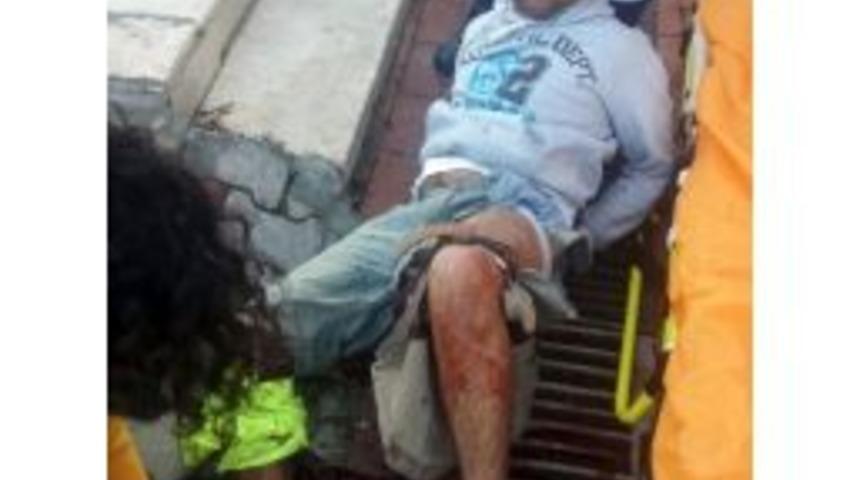 Polise Bı&ccedil;akla Saldıran Kablo Hırsızı Vurularak Yakalandı