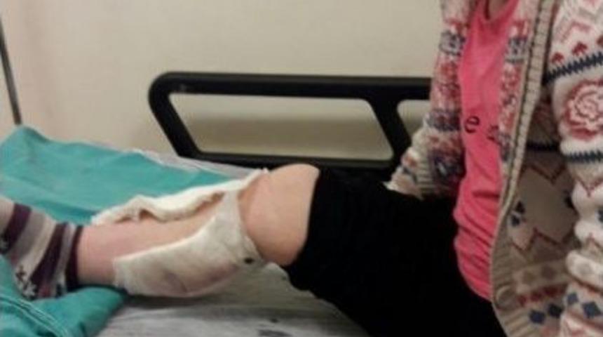 Zihinsel Engelli Kadına Sokak K&ouml;peği Saldırdı