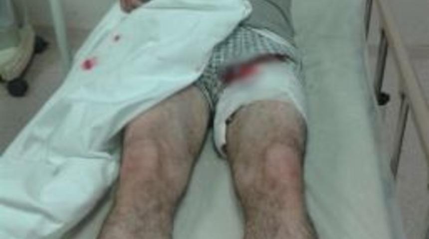 Ayının Saldırısına Uğrayan İnşaat Ustası Yaralandı