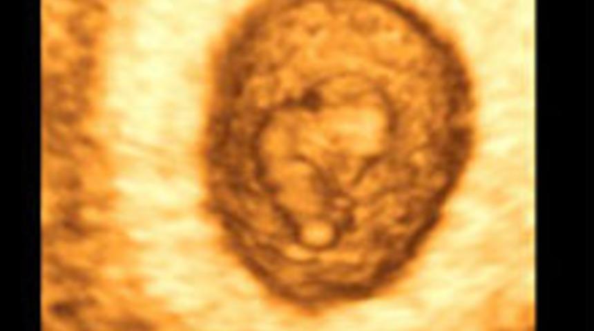 Hafta Hafta Gebelik Rehberi