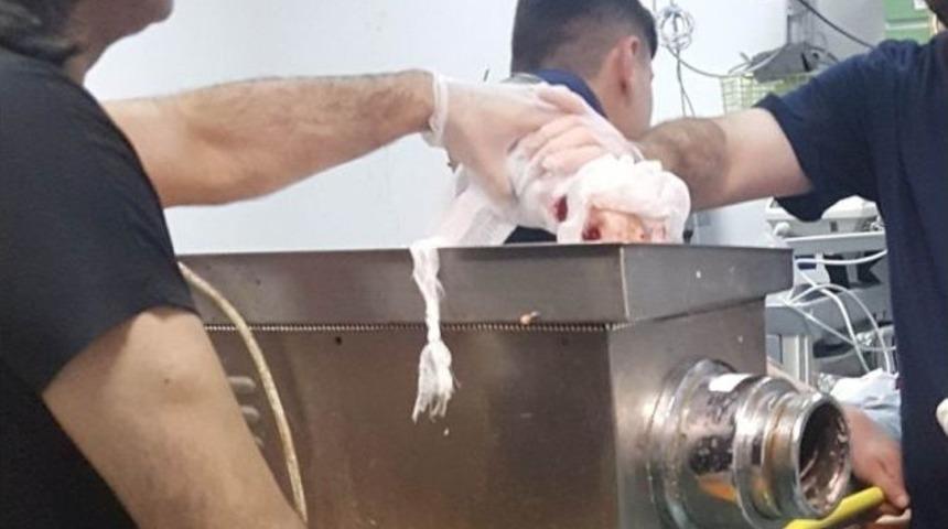 Elini Kaptırdığı Kıyma Makinesiyle Hastaneye Kaldırıldı