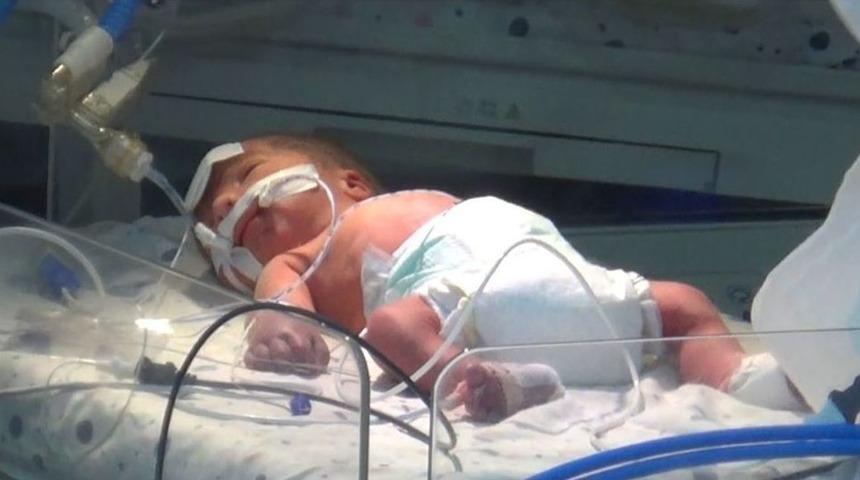 Annesi &Ouml;ld&uuml;r&uuml;len Bebeğin Hayati Aktivitelerinde İyileşme Var