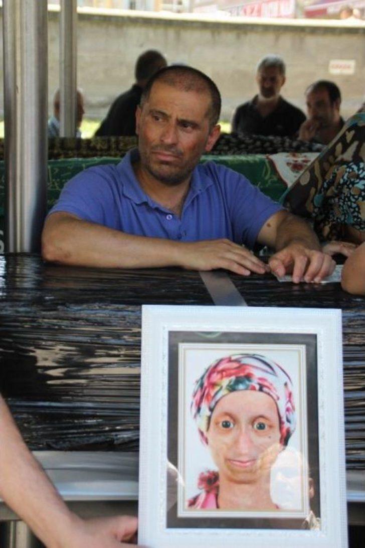 Hayatını Kaybeden Yaşlanma Hastası Gamze Son Yolculuğuna Uğurlandı G1