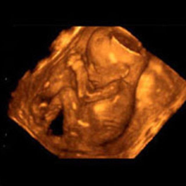 В 20 недель голова. УЗИ плода на 19 неделе беременности. 3д УЗИ на 19 неделе беременности. УЗИ ребенка на 19 неделе беременности. Снимки УЗИ на 19 неделе беременности.