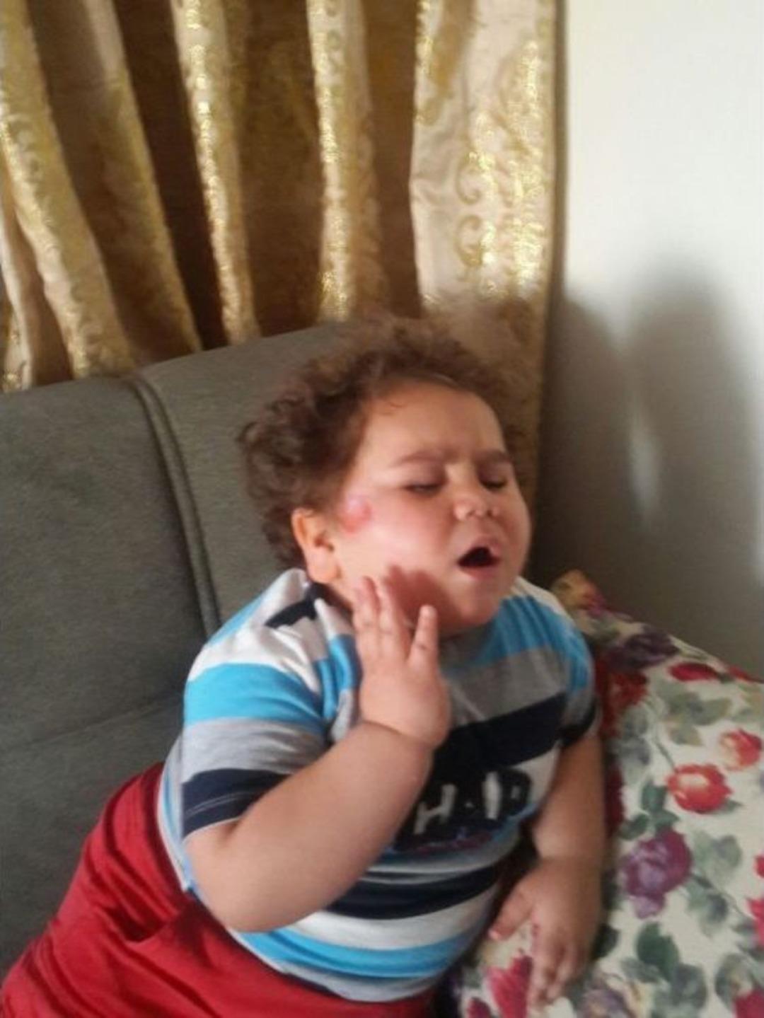 (&ouml;zel Haber) &Ccedil;itos Efe&rsquo;ye Nazar Değdi